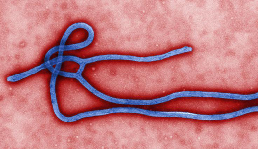 警惕最新病毒病人，你需要了解這些關(guān)鍵信息！