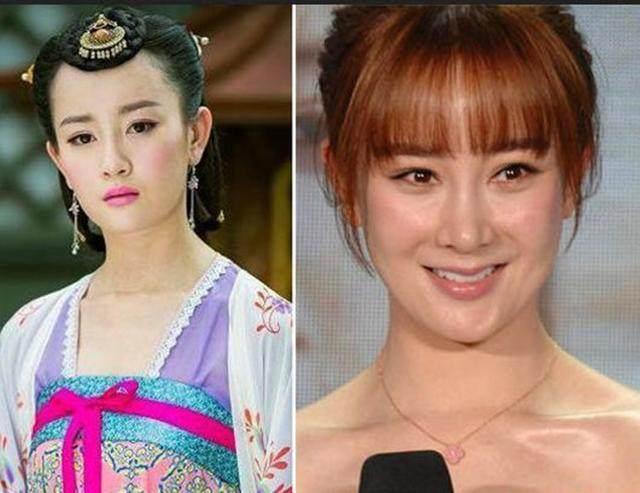 坦然面對整容，女明星的美麗新篇章之旅