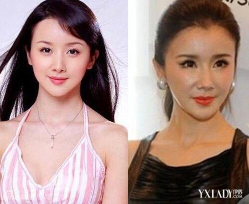 探秘明星整容的秘密，神秘美容小店的魅力所在！